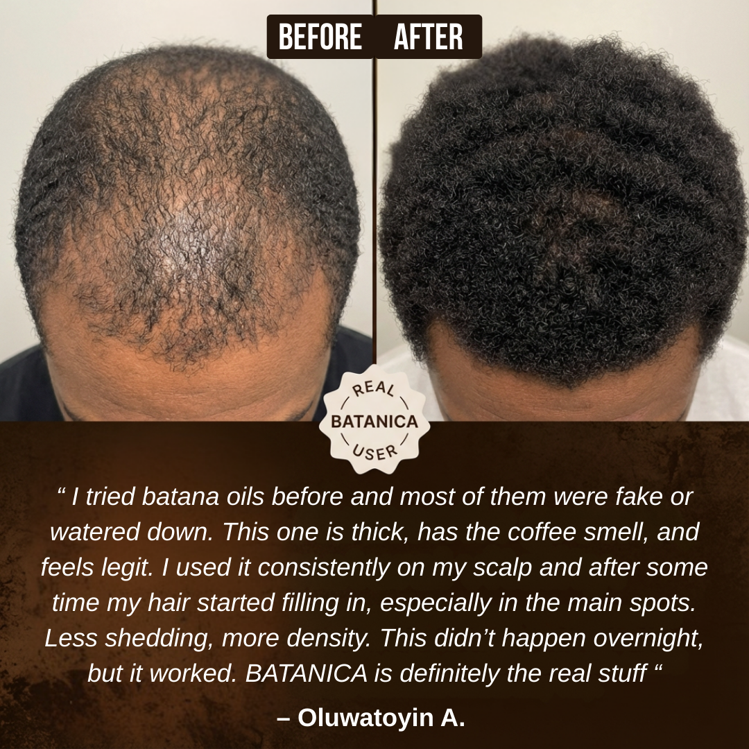 100% Liquid Batana Oil