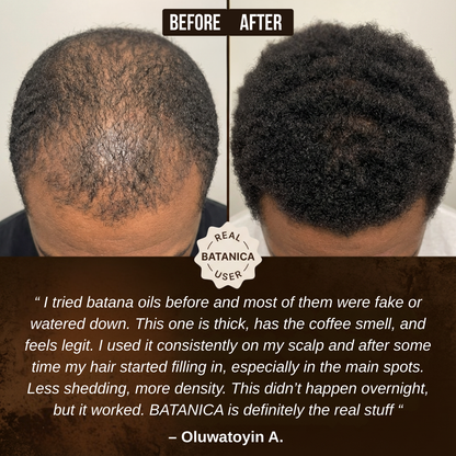 100% Liquid Batana Oil