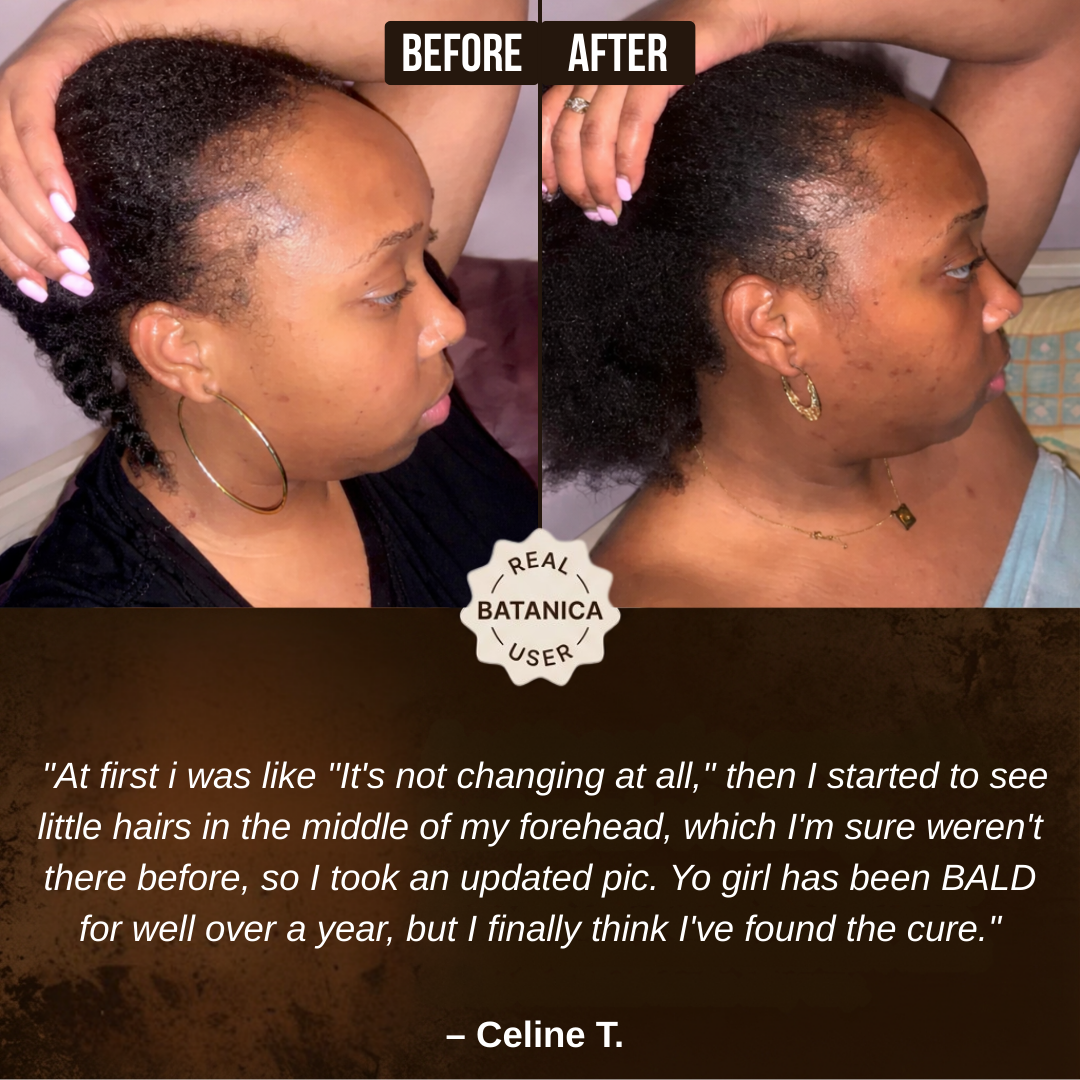 100% Liquid Batana Oil