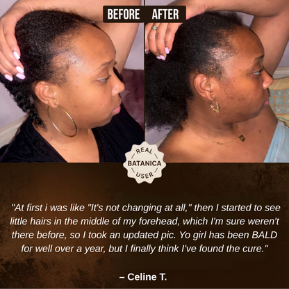 100% Liquid Batana Oil