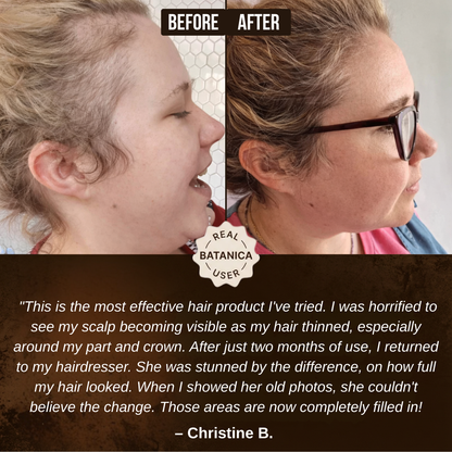 100% Liquid Batana Oil