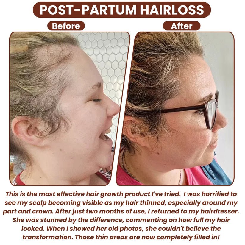 100% Unrefined Batana Oil