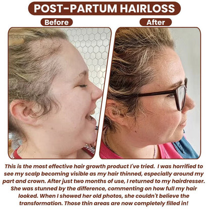 100% Unrefined Batana Oil